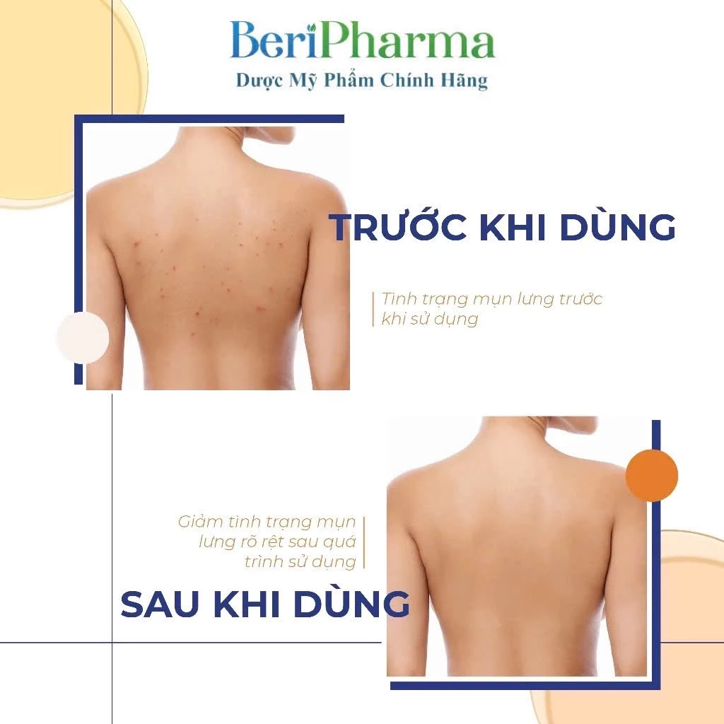 product-media-img
